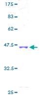 12.5% SDS-PAGE Stained with Coomassie Blue.